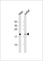 MRPL48 Antibody - All lanes: Anti-MRPL48 Antibody at 1:1000 dilution. Lane 1: HeLa whole cell lysate. Lane 2: Jurkat whole cell lysate Lysates/proteins at 20 ug per lane. Secondary Goat Anti-Rabbit IgG, (H+L), Peroxidase conjugated at 1:10000 dilution. Predicted band size: 24 kDa. Blocking/Dilution buffer: 5% NFDM/TBST.
