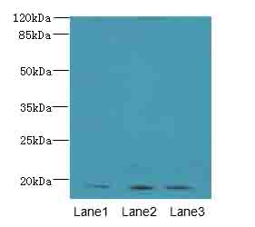 MRPL49 Antibody - Western blot. All lanes: MRPL49 antibody at 0.6 ug/ml. Lane 1: Colo320 whole cell lysate. Lane 2: Mouse liver tissue. Lane 3: Mouse kidney tissue. Secondary Goat polyclonal to Rabbit IgG at 1:10000 dilution. Predicted band size: 19 kDa. Observed band size: 19 kDa.