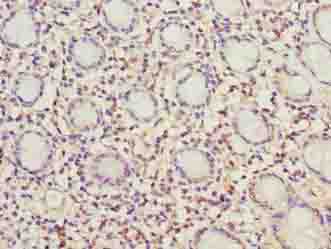 MRPL49 Antibody - Immunohistochemistry of paraffin-embedded human rectum tissue using antibody at dilution of 1:100.