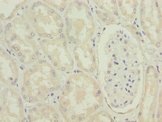 MRPL49 Antibody - Immunohistochemistry of paraffin-embedded human kidney tissue using MRPL49 Antibody at dilution of 1:100