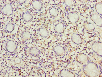 MRPL49 Antibody - Immunohistochemistry of paraffin-embedded human rectum tissue using MRPL49 Antibody at dilution of 1:100