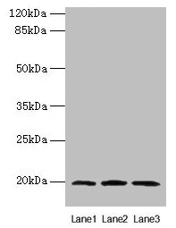 MRPL49 Antibody - Western blot All lanes: MRPL49 antibody at 0.6µg/ml Lane 1: Colo320 whole cell lysate Lane 2: Mouse liver tissue Lane 3: Mouse kidney tissue Secondary Goat polyclonal to rabbit IgG at 1/10000 dilution Predicted band size: 19 kDa Observed band size: 19 kDa