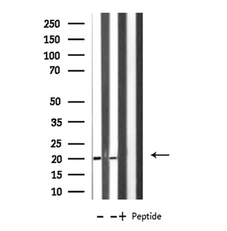 MRPL49 Antibody - Western blot analysis of extracts of HeLa/COLO205 cells using MRPL49 antibody.