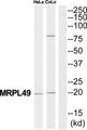 MRPL49 Antibody - Western blot analysis of extracts from HeLa/COLO205 cells, using MRPL49 antibody.