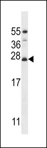 MRPL50 Antibody - RM50 Antibody western blot of MDA-MB435 cell line lysates (35 ug/lane). The RM50 antibody detected the RM50 protein (arrow).