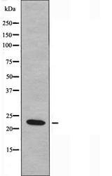 MRPL50 Antibody - Western blot analysis of extracts of COLO cells using MRPL50 antibody.