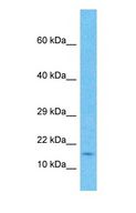 MRPL50 Antibody - Western blot of RM50 Antibody with human Stomach Tumor lysate.  This image was taken for the unconjugated form of this product. Other forms have not been tested.