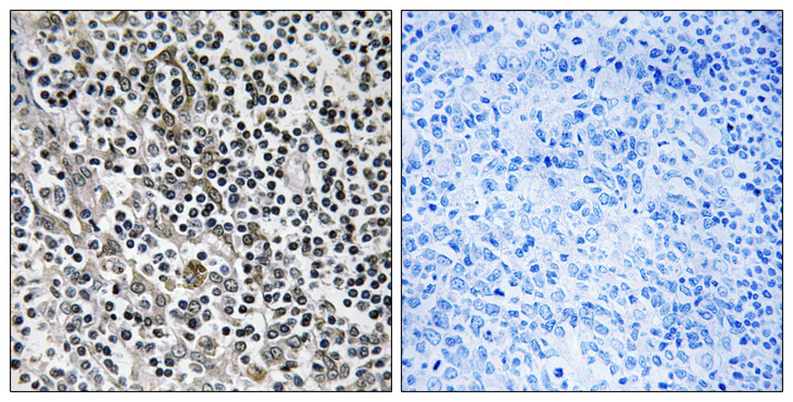 MRPL51 Antibody - Immunohistochemistry analysis of paraffin-embedded human tonsil tissue, using MRPL51 Antibody. The picture on the right is blocked with the synthesized peptide.