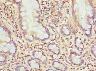 MRPL51 Antibody - Immunohistochemistry of paraffin-embedded human small intestine tissue using antibody at dilution of 1:100.