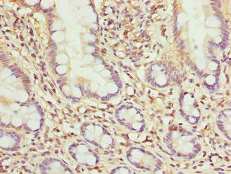 MRPL51 Antibody - Immunohistochemistry of paraffin-embedded human small intestine tissue using MRPL51 Antibody at dilution of 1:100