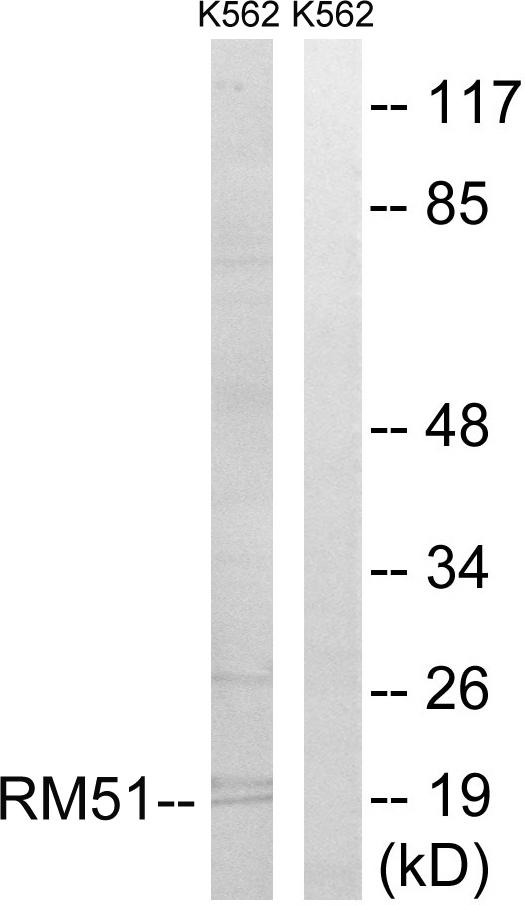 MRPL51 Antibody - Western blot analysis of extracts from K562 cells, using MRPL51 antibody.