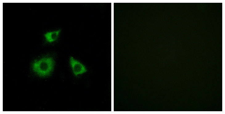 MRPL52 Antibody - Immunofluorescence analysis of HUVEC cells, using MRPL52 Antibody. The picture on the right is blocked with the synthesized peptide.