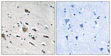 MRPL52 Antibody - Immunohistochemistry analysis of paraffin-embedded human brain tissue, using MRPL52 Antibody. The picture on the right is blocked with the synthesized peptide.