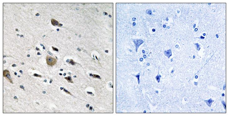 MRPL52 Antibody - Peptide - + Immunohistochemistry analysis of paraffin-embedded human brain tissue using MRPL52 antibody.