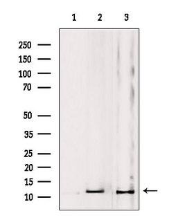 MRPL53 Antibody - Western blot analysis of extracts of various samples using MRPL53 antibody. Lane 1: mouse Myeloma cells treated with blocking peptide. Lane 2: mouse Myeloma cells; Lane 3: HeLa;