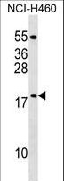 MRPL54 Antibody - MRPL54 Antibody western blot of NCI-H460 cell line lysates (35 ug/lane). The MRPL54 antibody detected the MRPL54 protein (arrow).