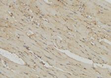 MRPL54 Antibody - 1:100 staining mouse muscle tissue by IHC-P. The sample was formaldehyde fixed and a heat mediated antigen retrieval step in citrate buffer was performed. The sample was then blocked and incubated with the antibody for 1.5 hours at 22°C. An HRP conjugated goat anti-rabbit antibody was used as the secondary.