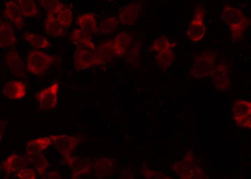 MRPL54 Antibody - Staining HeLa cells by IF/ICC. The samples were fixed with PFA and permeabilized in 0.1% Triton X-100, then blocked in 10% serum for 45 min at 25°C. The primary antibody was diluted at 1:200 and incubated with the sample for 1 hour at 37°C. An Alexa Fluor 594 conjugated goat anti-rabbit IgG (H+L) Ab, diluted at 1/600, was used as the secondary antibody.