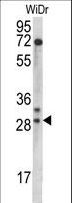 MRPL9 Antibody - MRPL9 Antibody western blot of WiDr cell line lysates (35 ug/lane). The MRPL9 antibody detected the MRPL9 protein (arrow).