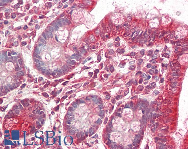 MRPL9 Antibody - Anti-MRPL9 antibody IHC staining of human small intestine. Immunohistochemistry of formalin-fixed, paraffin-embedded tissue after heat-induced antigen retrieval. Antibody concentration 10 ug/ml.  This image was taken for the unconjugated form of this product. Other forms have not been tested.