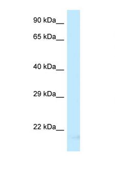 MRPS11 Antibody - MRPS11 antibody Western blot of 721_B Cell lysate. Antibody concentration 1 ug/ml.  This image was taken for the unconjugated form of this product. Other forms have not been tested.