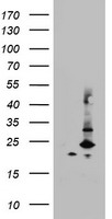 MRPS11 Antibody - HEK293T cells were transfected with the pCMV6-ENTRY control (Left lane) or pCMV6-ENTRY MRPS11 (Right lane) cDNA for 48 hrs and lysed. Equivalent amounts of cell lysates (5 ug per lane) were separated by SDS-PAGE and immunoblotted with anti-MRPS11.