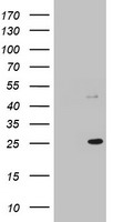 MRPS11 Antibody - HEK293T cells were transfected with the pCMV6-ENTRY control (Left lane) or pCMV6-ENTRY MRPS11 (Right lane) cDNA for 48 hrs and lysed. Equivalent amounts of cell lysates (5 ug per lane) were separated by SDS-PAGE and immunoblotted with anti-MRPS11.