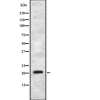 MRPS11 Antibody - Western blot analysis of MRPS11 using MCF-7 whole cells lysates