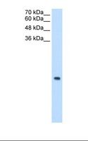 MRPS12 / RPSM12 Antibody - Jurkat cell lysate. Antibody concentration: 0.5 ug/ml. Gel concentration: 15%.  This image was taken for the unconjugated form of this product. Other forms have not been tested.