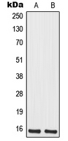 MRPS12 / RPSM12 Antibody - Western blot analysis of MRPS12 expression in Jurkat (A); HeLa (B) whole cell lysates.