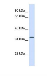 MRPS15 Antibody - Fetal liver lysate. Antibody concentration: 1.0 ug/ml. Gel concentration: 12%.  This image was taken for the unconjugated form of this product. Other forms have not been tested.