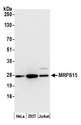 MRPS15 Antibody - Detection of human MRPS15 by western blot. Samples: Whole cell lysate (50 µg) from HeLa, HEK293T, and Jurkat cells prepared using NETN lysis buffer. Antibody: Affinity purified rabbit anti-MRPS15 antibody used for WB at 0.04 µg/ml. Detection: Chemiluminescence with an exposure time of 30 seconds.