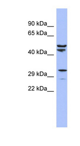 MRPS15 Antibody - MRPS15 antibody Western blot of Fetal Thymus lysate. This image was taken for the unconjugated form of this product. Other forms have not been tested.
