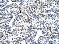 MRPS15 Antibody - MRPS15 antibody MRPS15(mitochondrial ribosomal protein S15) Antibody was used in IHC to stain formalin-fixed, paraffin-embedded human lung.  This image was taken for the unconjugated form of this product. Other forms have not been tested.