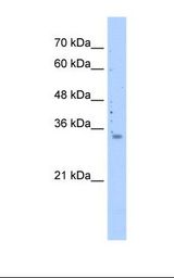 MRPS15 Antibody - 721_B cell lysate. Antibody concentration: 0.5 ug/ml. Gel concentration: 12%.  This image was taken for the unconjugated form of this product. Other forms have not been tested.