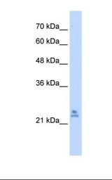 MRPS15 Antibody - 721_B cell lysate. Antibody concentration: 2.5 ug/ml. Gel concentration: 12%.  This image was taken for the unconjugated form of this product. Other forms have not been tested.
