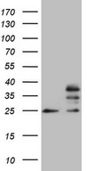 MRPS15 Antibody - HEK293T cells were transfected with the pCMV6-ENTRY control. (Left lane) or pCMV6-ENTRY MRPS15. (Right lane) cDNA for 48 hrs and lysed. Equivalent amounts of cell lysates. (5 ug per lane) were separated by SDS-PAGE and immunoblotted with anti-MRPS15. (1:2000)