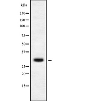 MRPS15 Antibody - Western blot analysis of MRPS15 using Jurkat whole cells lysates
