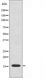 MRPS16 Antibody - Western blot analysis of extracts of HepG2 cells using MRPS16 antibody.