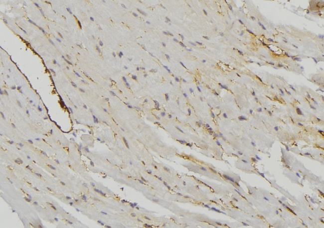 MRPS16 Antibody - 1:100 staining mouse muscle tissue by IHC-P. The sample was formaldehyde fixed and a heat mediated antigen retrieval step in citrate buffer was performed. The sample was then blocked and incubated with the antibody for 1.5 hours at 22°C. An HRP conjugated goat anti-rabbit antibody was used as the secondary.