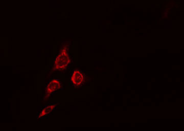 MRPS16 Antibody - Staining HepG2 cells by IF/ICC. The samples were fixed with PFA and permeabilized in 0.1% Triton X-100, then blocked in 10% serum for 45 min at 25°C. The primary antibody was diluted at 1:200 and incubated with the sample for 1 hour at 37°C. An Alexa Fluor 594 conjugated goat anti-rabbit IgG (H+L) antibody, diluted at 1/600, was used as secondary antibody.