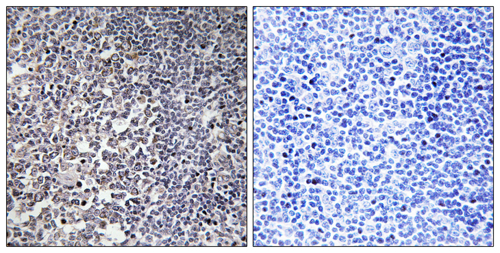 MRPS16 Antibody - Immunohistochemistry analysis of paraffin-embedded human tonsil tissue, using MRPS16 Antibody. The picture on the right is blocked with the synthesized peptide.