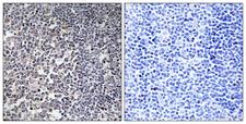 MRPS16 Antibody - Immunohistochemistry analysis of paraffin-embedded human tonsil tissue, using MRPS16 Antibody. The picture on the right is blocked with the synthesized peptide.