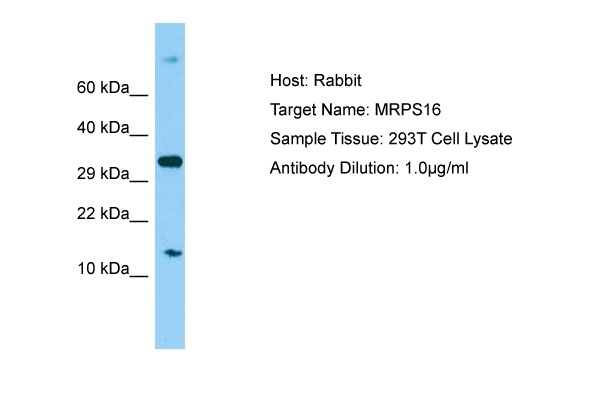 MRPS16 Antibody -  This image was taken for the unconjugated form of this product. Other forms have not been tested.