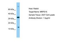 MRPS16 Antibody -  This image was taken for the unconjugated form of this product. Other forms have not been tested.