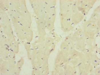 MRPS16 Antibody - Immunohistochemistry of paraffin-embedded human heart tissue at dilution of 1:100