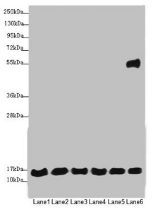 MRPS16 Antibody - Western blot All Lanes:MRPS16 antibody at 1.12 ug/ml Lane 1: 293T whole cell lysate Lane 2: Jurkat whole cell lysate Lane 3: Hela whole cell lysate Lane 4: MCF7 whole cell lysate Lane 5: Raji whole cell lysate Lane 6: HepG-2 whole cell lysate Secondary Goat polyclonal to rabbit IgG at 1/10000 dilution Predicted band size: 16,14 kDa Observed band size: 15,55 kDa