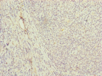 MRPS16 Antibody - Immunohistochemistry of paraffin-embedded human tonsil tissue at dilution of 1:100