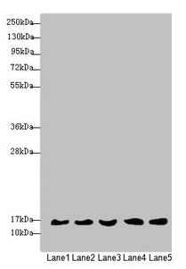 MRPS16 Antibody - Western blot All lanes: MRPS16 antibody at 1.35µg/ml Lane 1: Mouse liver tissue Lane 2: 293T whole cell lysate Lane 3: Jurkat whole cell lysate Lane 4: Raji whole cell lysate Lane 5: HepG2 whole cell lysate Secondary Goat polyclonal to rabbit IgG at 1/10000 dilution Predicted band size: 16, 14 kDa Observed band size: 16 kDa