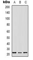 MRPS17 Antibody - Western blot analysis of MRPS17 expression in SHSY5Y (A); HEK293T (B); NIH3T3 (C) whole cell lysates.